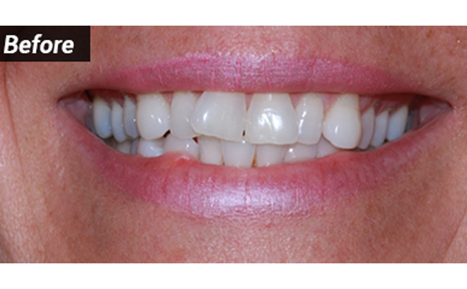 Before - Westcountry Dental and Implant Centre