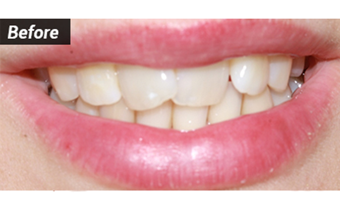 Before - Westcountry Dental and Implant Centre