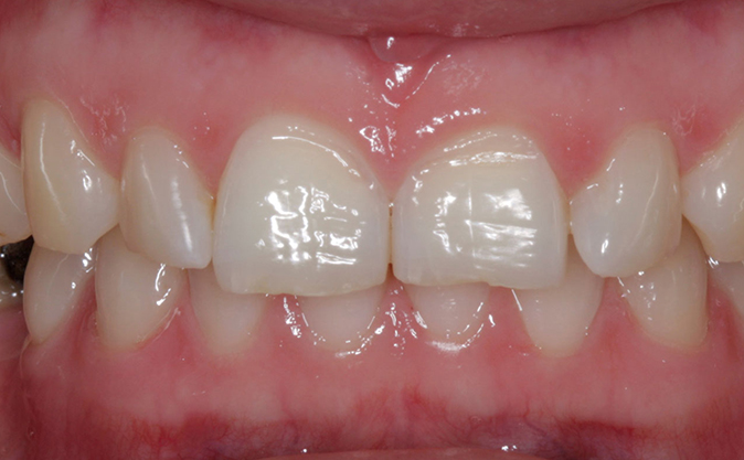 Before - Westcountry Dental and Implant Centre