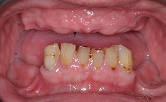 Before - Westcountry Dental and Implant Centre