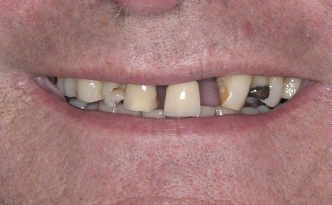Before - Westcountry Dental and Implant Centre