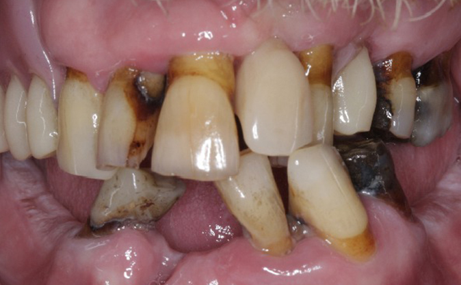 Before - Westcountry Dental and Implant Centre