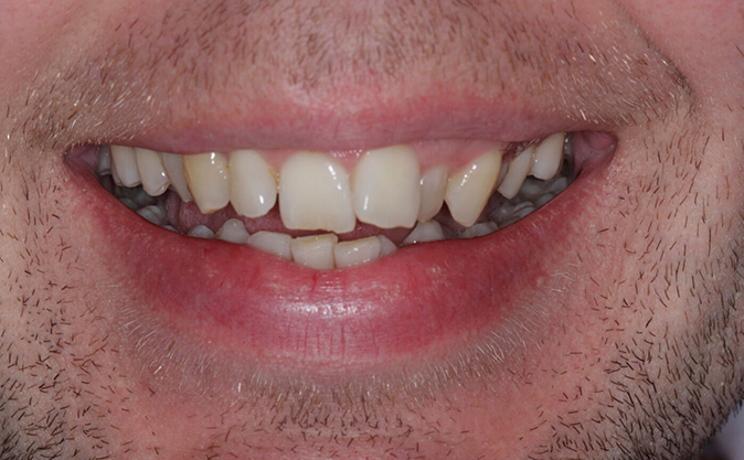 Before - Westcountry Dental and Implant Centre