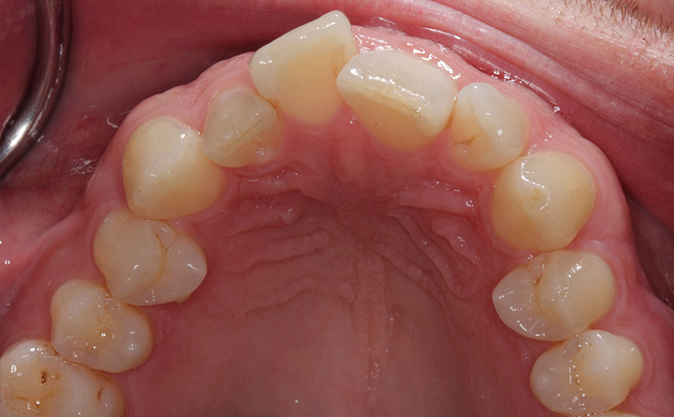 Before - Westcountry Dental and Implant Centre