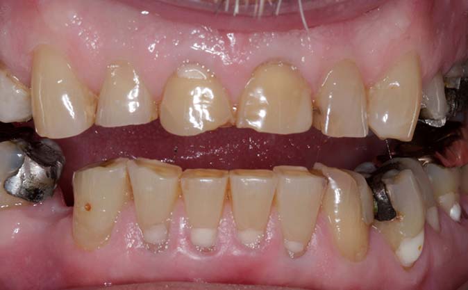 Before - Westcountry Dental and Implant Centre