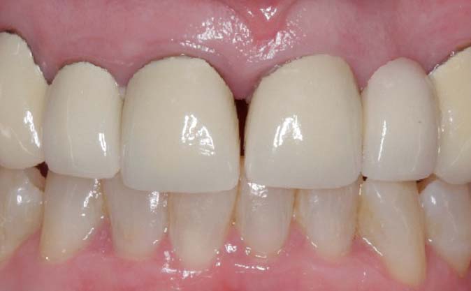 Before - Westcountry Dental and Implant Centre