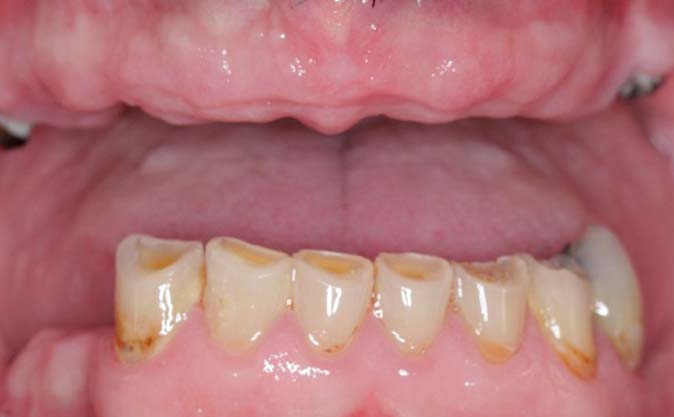 Before - Westcountry Dental and Implant Centre