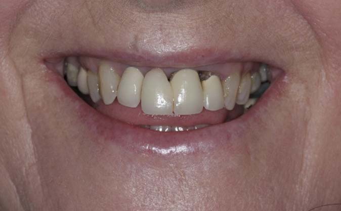 Before - Westcountry Dental and Implant Centre