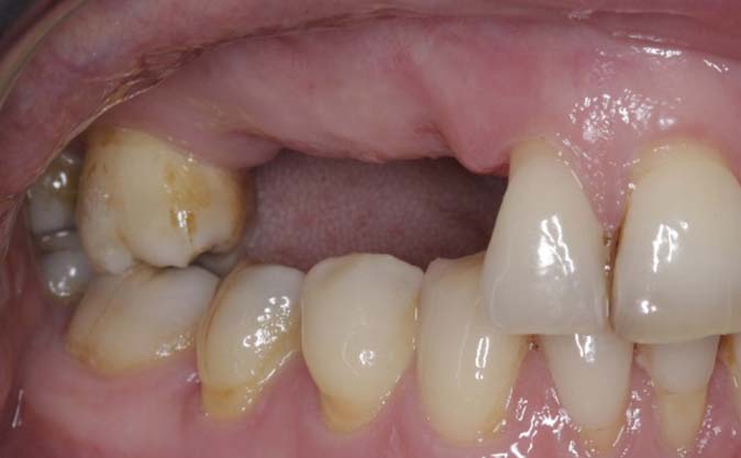 Before - Westcountry Dental and Implant Centre